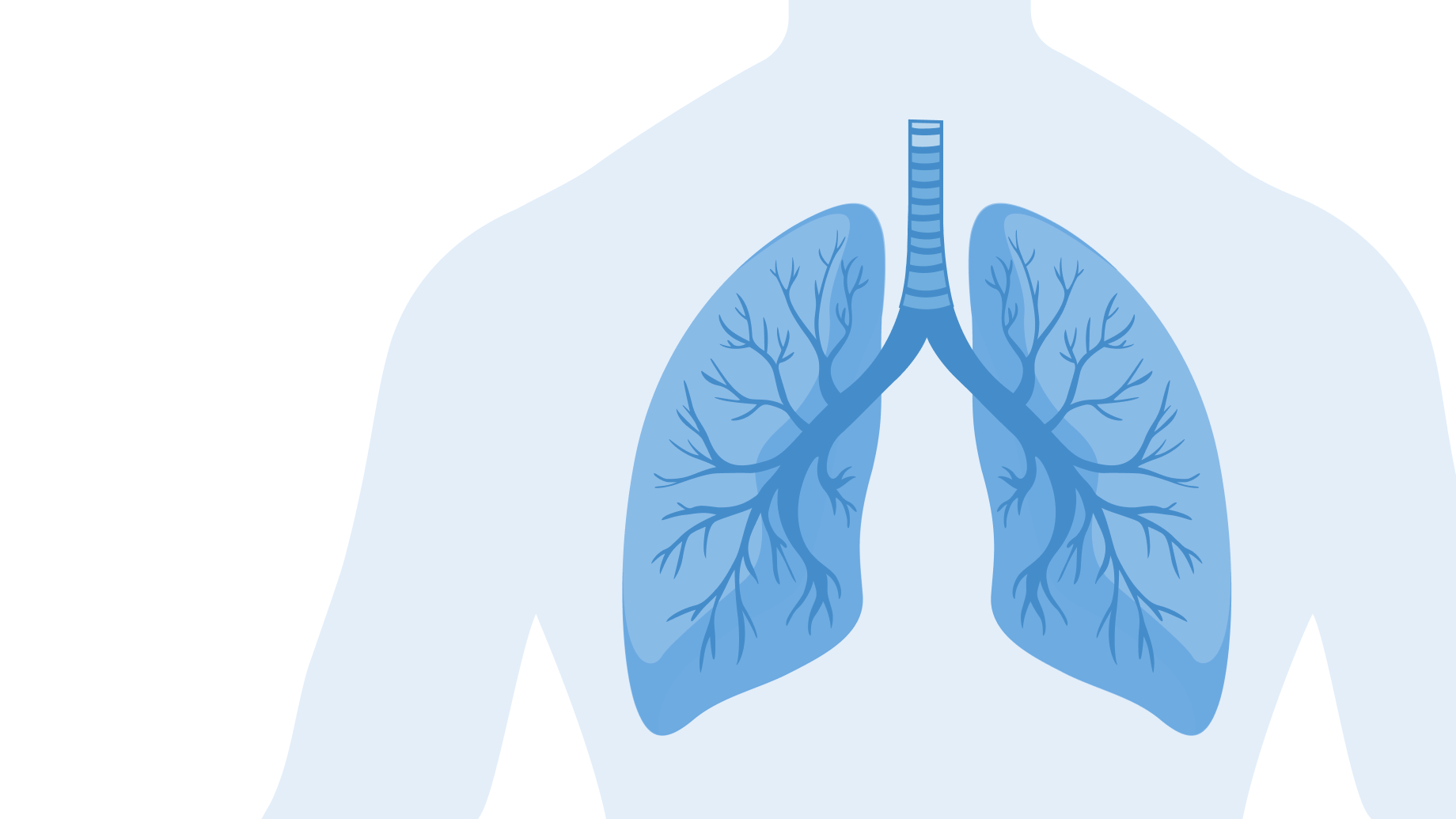 Cancro del polmone