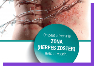 Informationen zu Herpes Zoster (Gürtelrose)