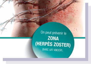 Informationen zu Herpes Zoster (Gürtelrose)