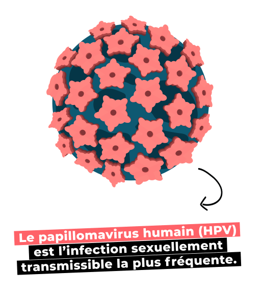 Le papillomavirus humain (HPV) est l’infection sexuellement transmissible la plus fréquente.