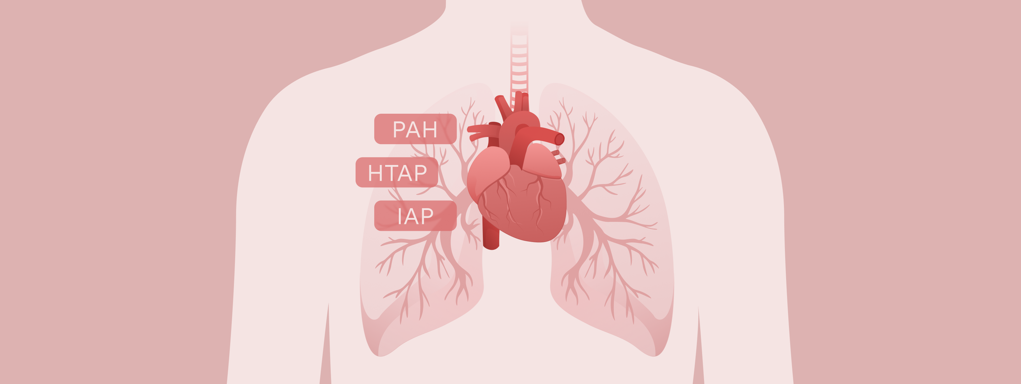 Banner: Pulmonale Arterielle Hypertonie