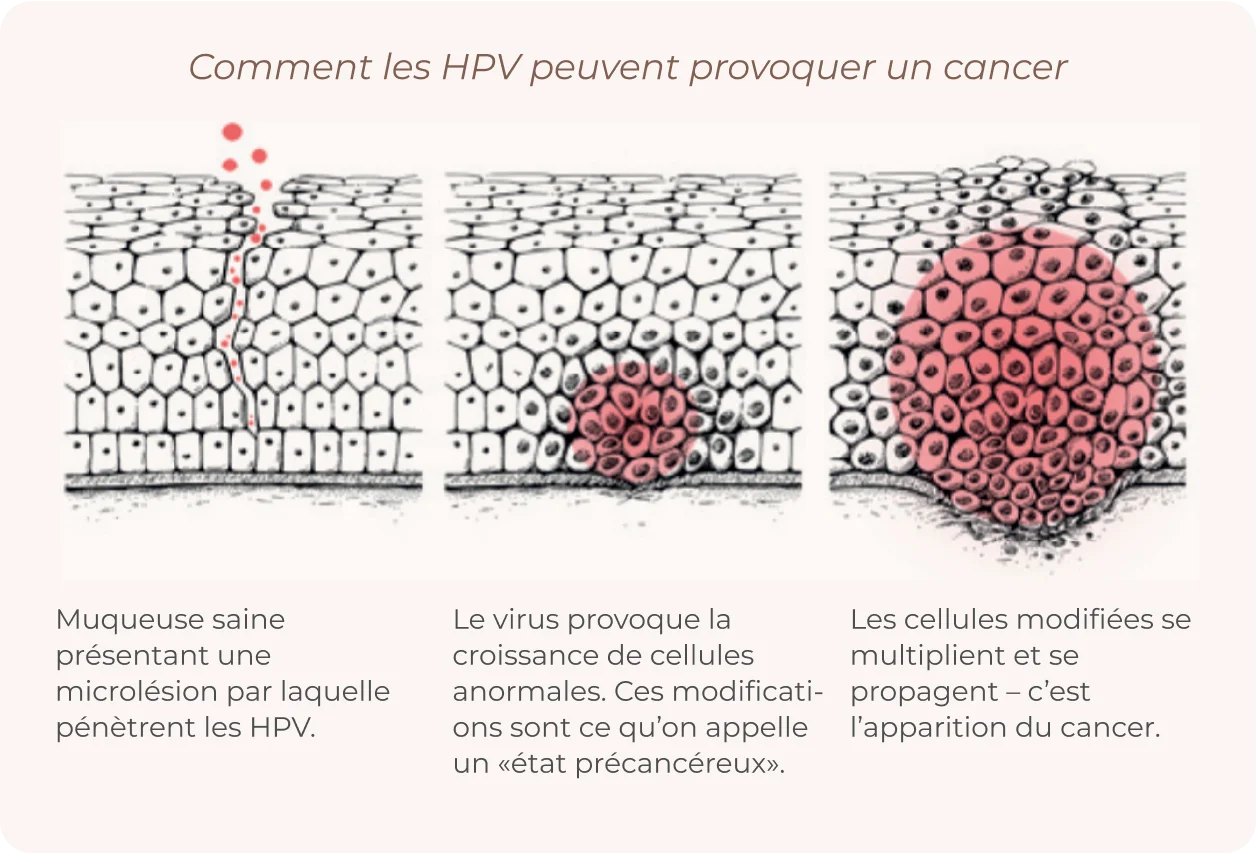 HPV process info