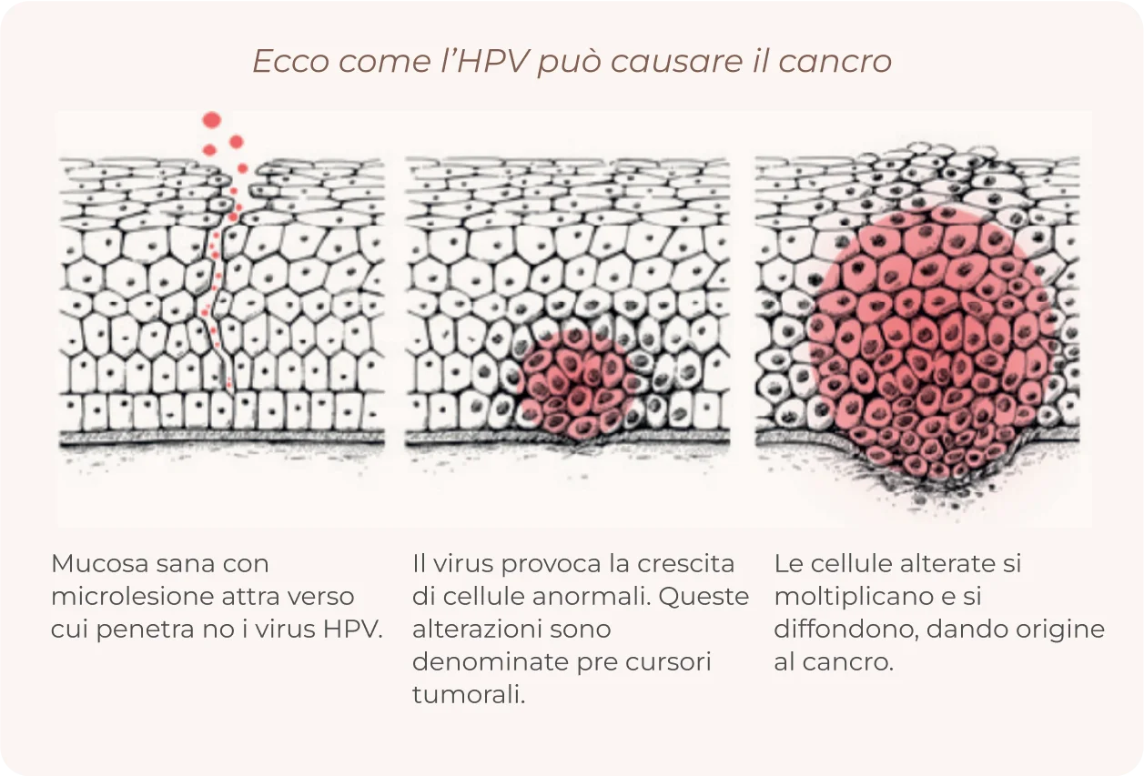 HPV process info