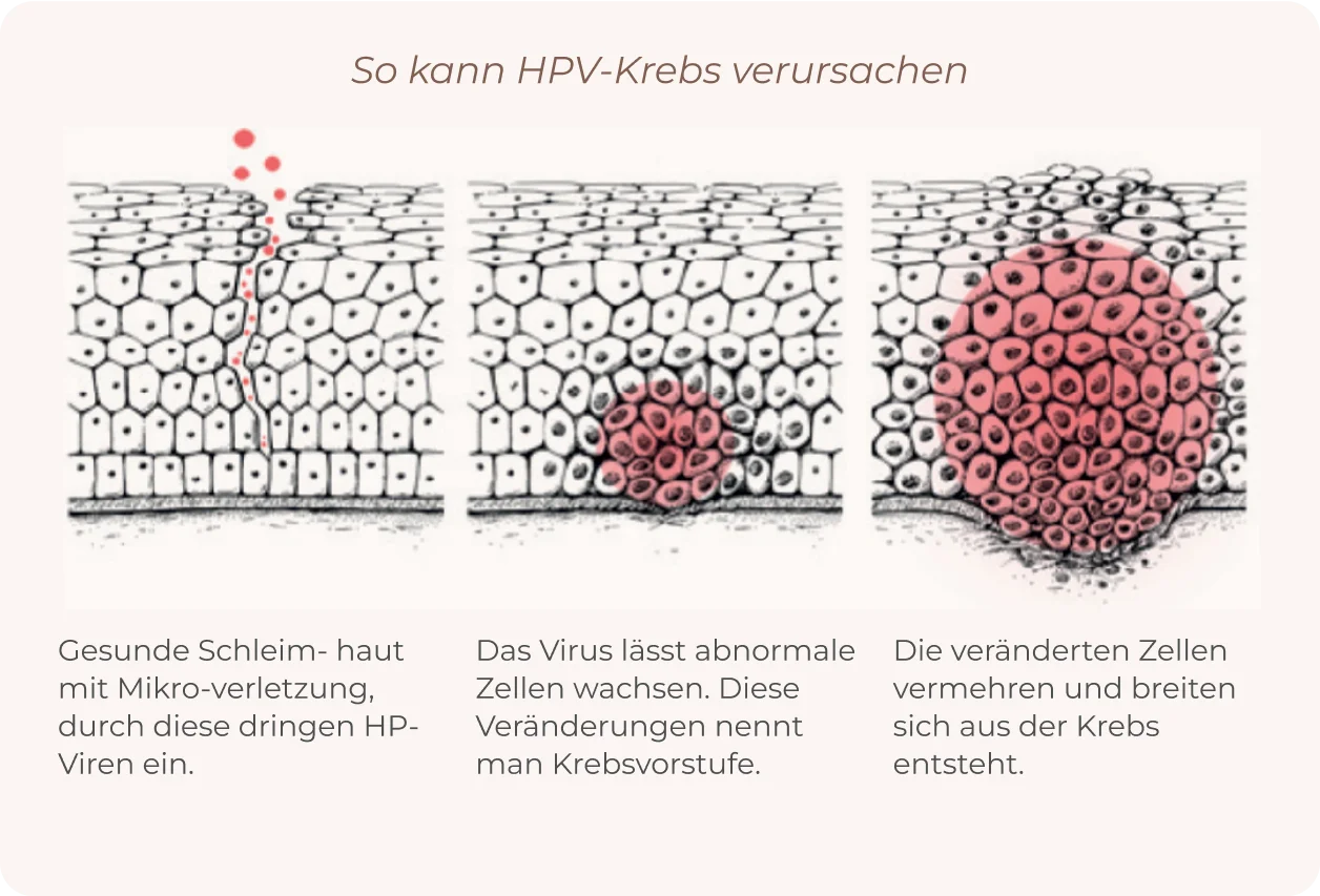 HPV process info
