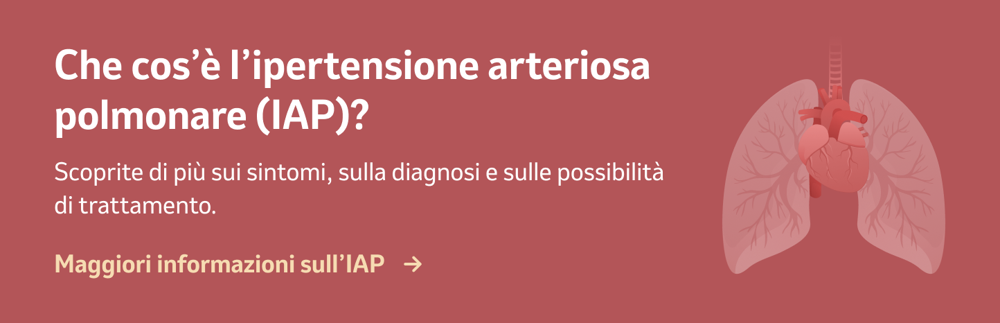 Maggiori informazioni sull’IAP