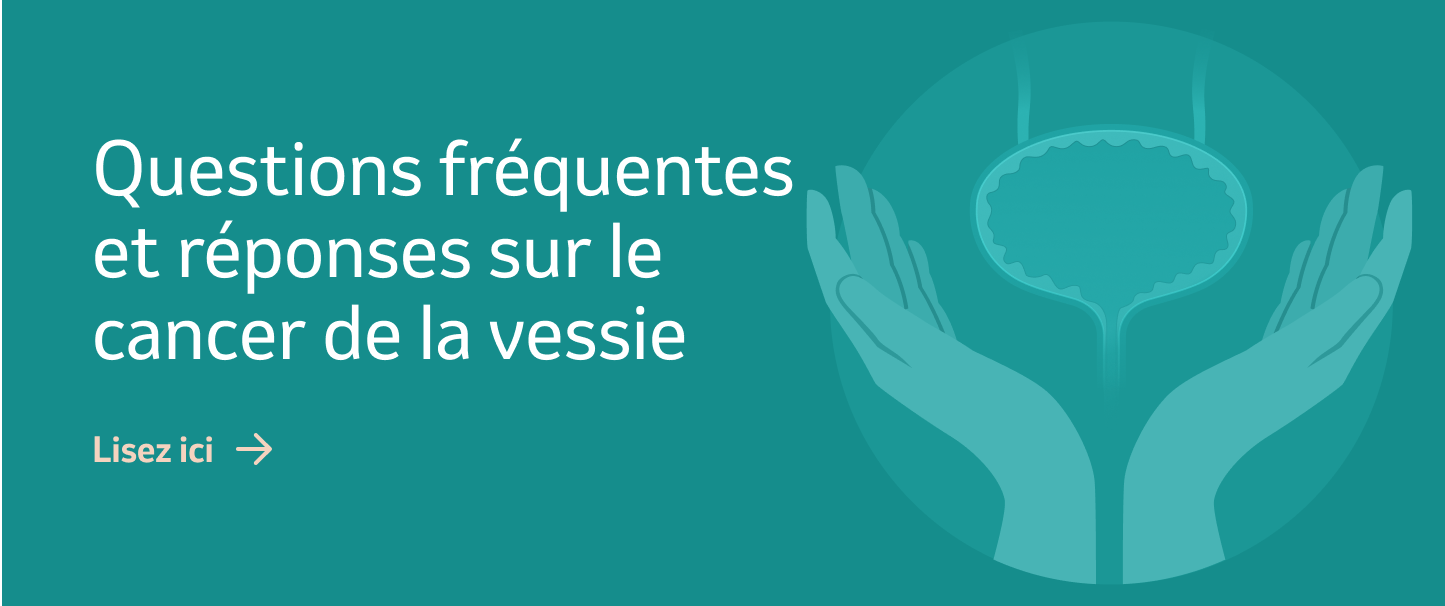 Banner Questions frequentes at reponses sur le cancer de la vessie