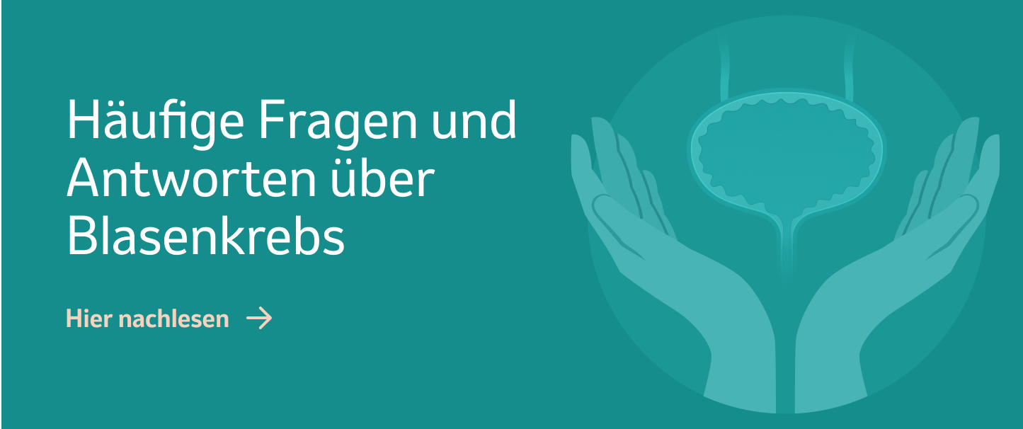 Banner Haeufige Fragen ueber Blasenkrebs