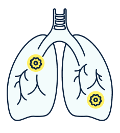lungs