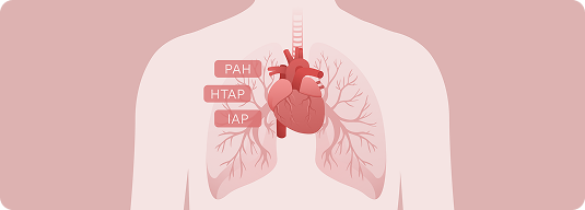 Was ist pulmonale arterielle Hypertonie (PAH)?