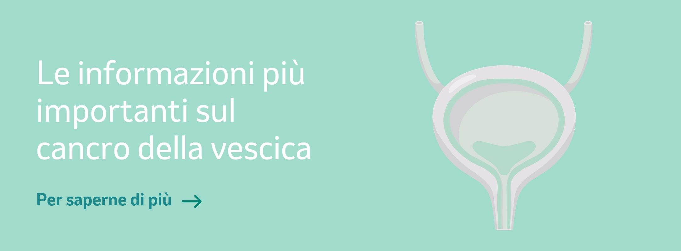 Banner "Le informazioni più importanti sul cancro della vescica"