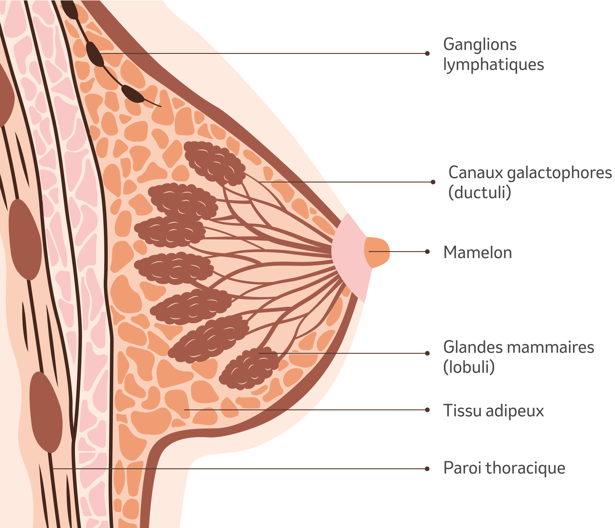 Qu'est-ce que le cancer du sein