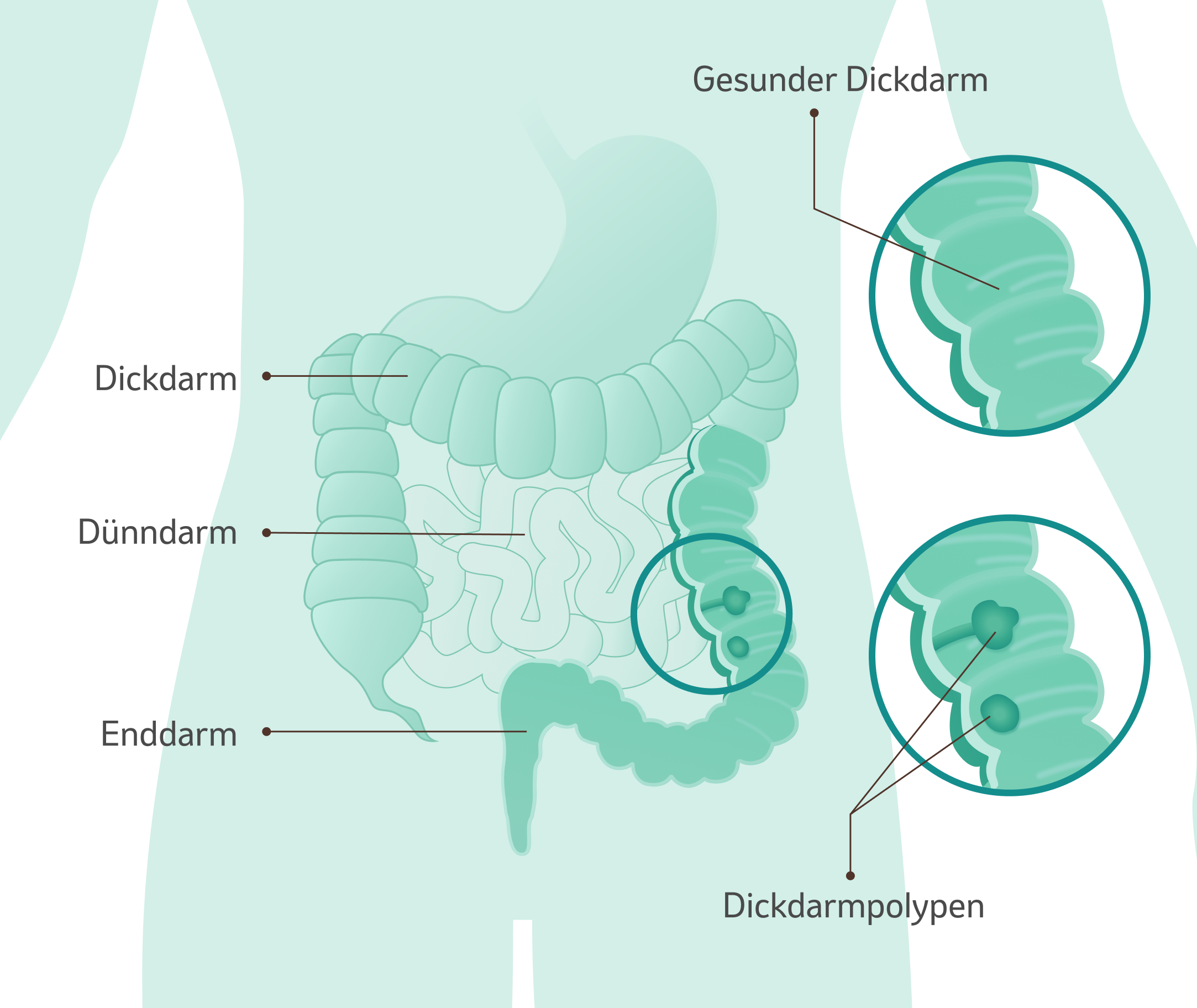 Illustration Darm mit Erklärung