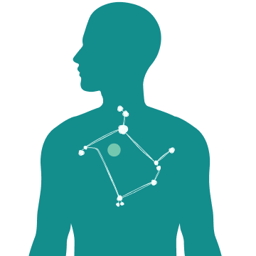 Illustrazione melanoma stadio IV