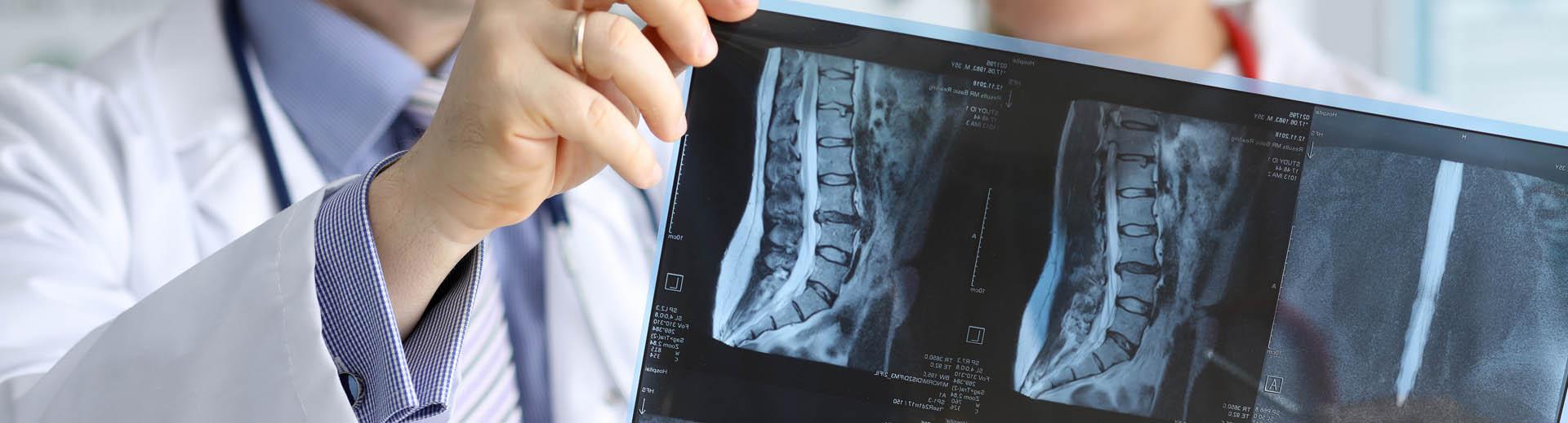 Ärzte betrachten Röntgenbild der Wirbelsäule