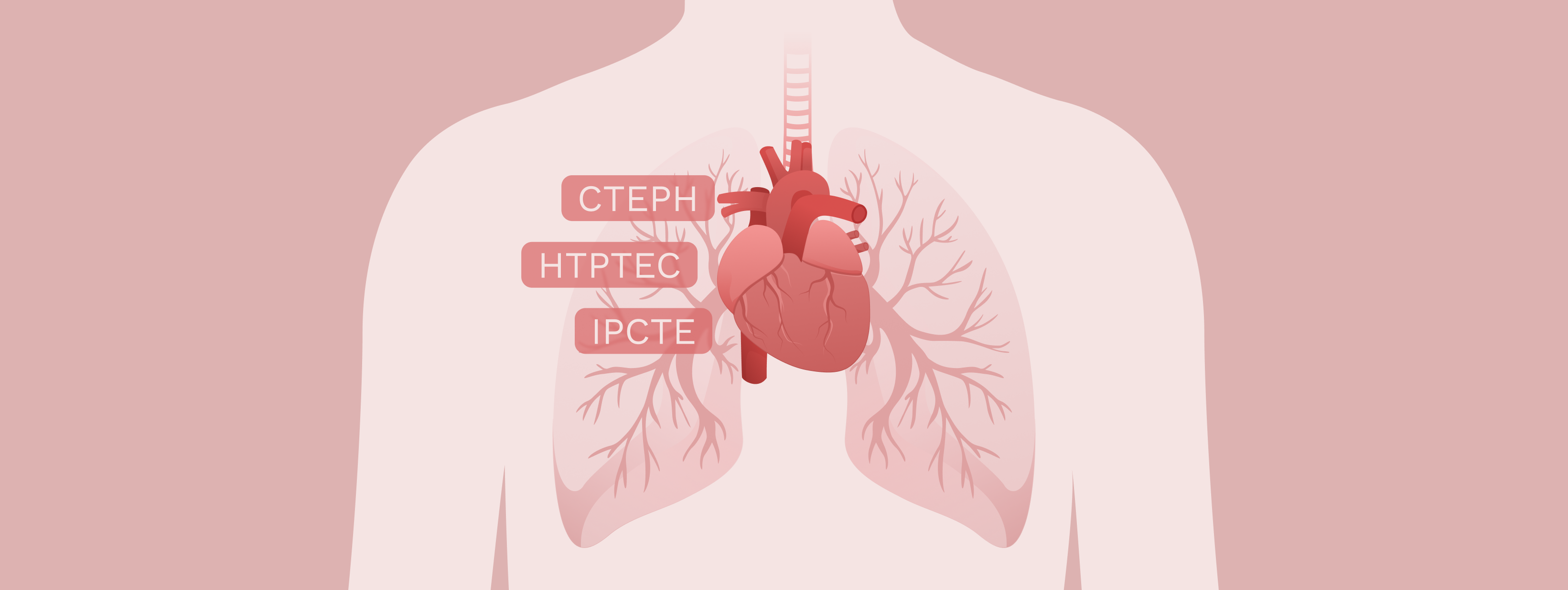 Banner: CTEPH